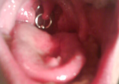 piercing19